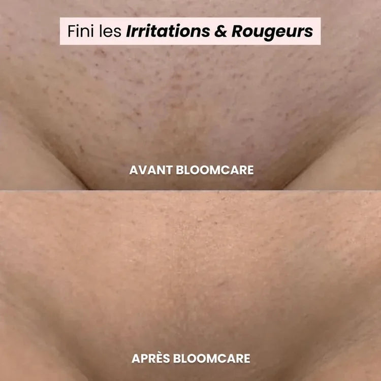 Rasoir BLOOMCARE®