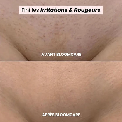 Rasoir BLOOMCARE®