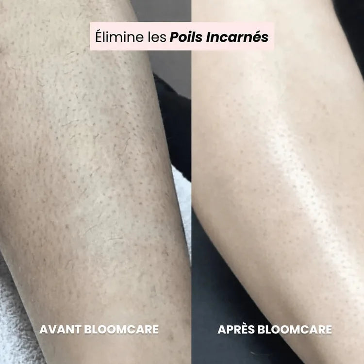 Rasoir BLOOMCARE®