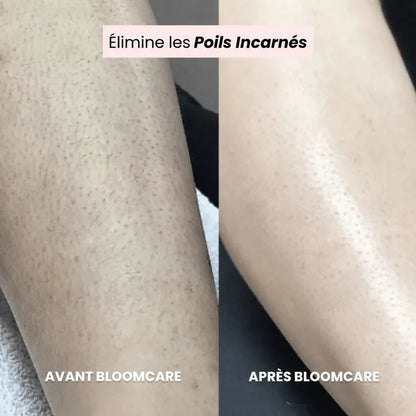 Rasoir BLOOMCARE®